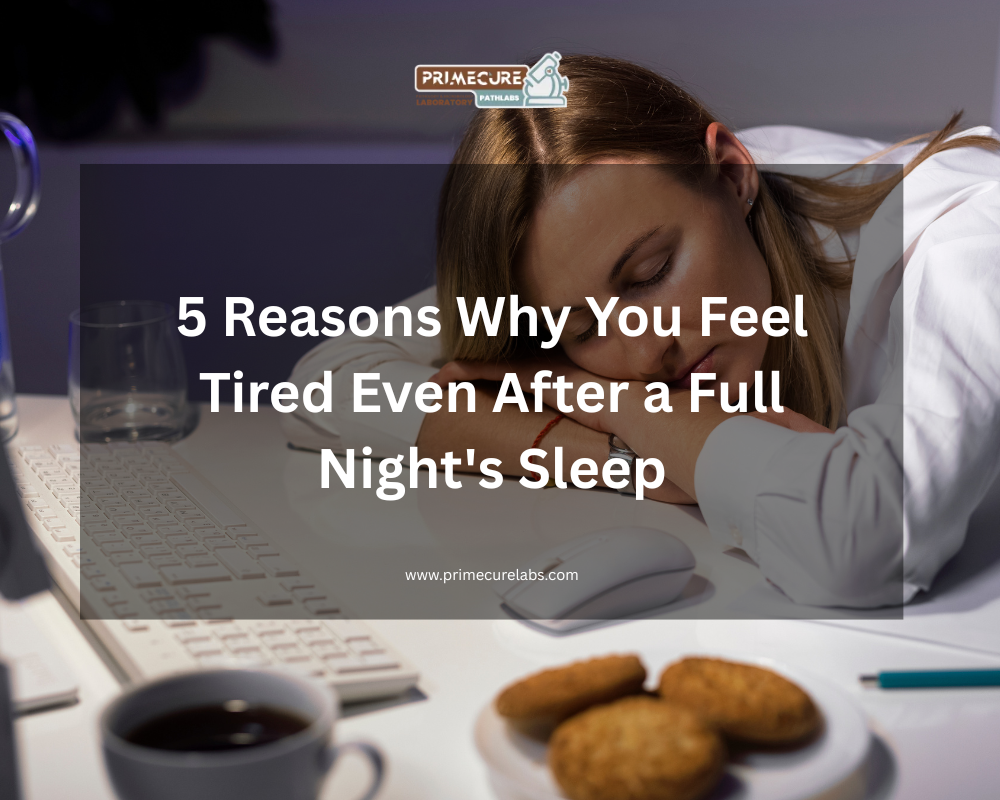 Tired After Full Sleep