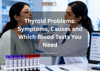 diabetes test in ahmedabad